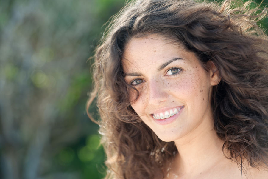 Smiling girl with freckles and Six Month Smile braces.