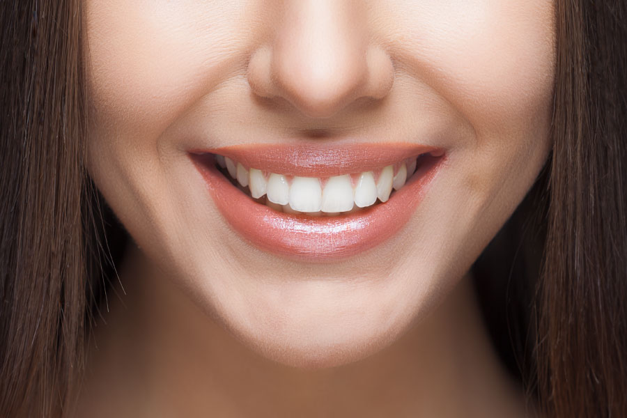 Lower face of a smiling female with white teeth.
